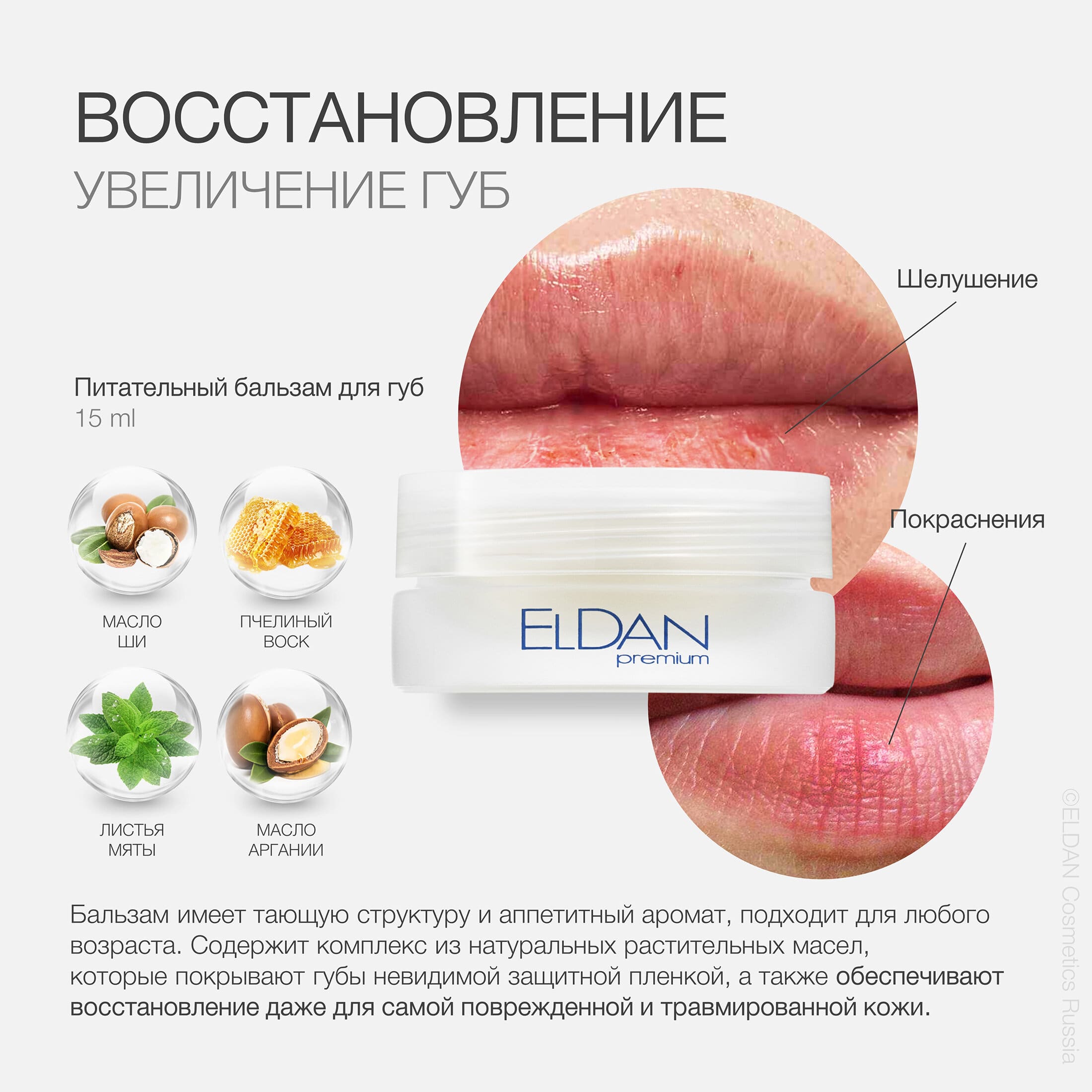 Пост увеличение губ 4.jpg Пост увеличение губ 4.jpg